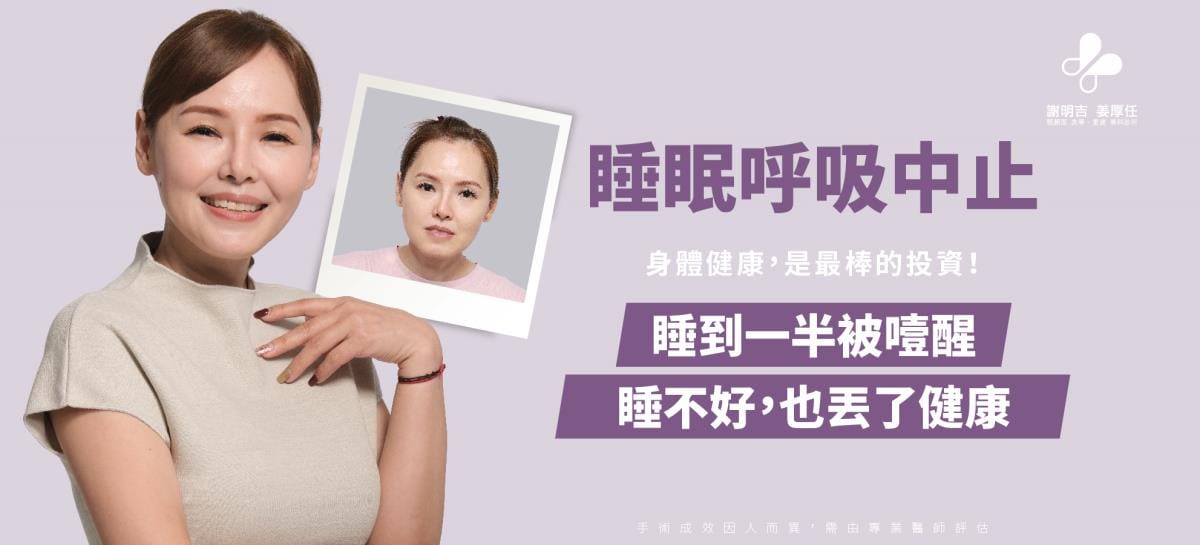 睡眠呼吸中止症女性患者正顎手術案例主視覺