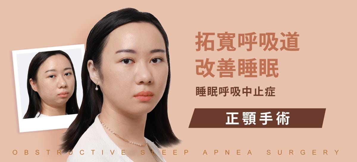 做過拔牙矯正，因為呼吸中止再做正顎手術
