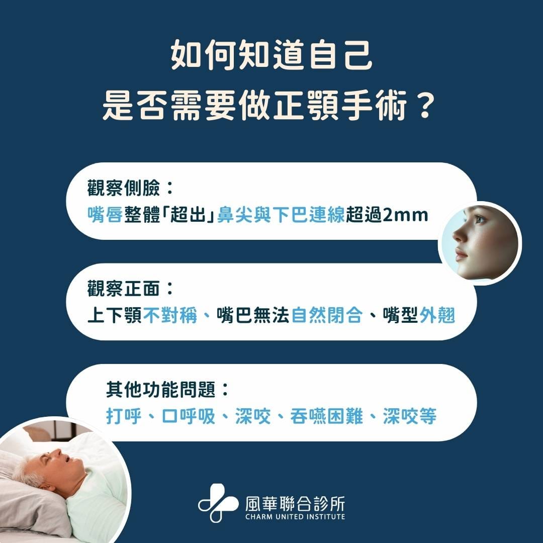 如何知道自己是否需要做正顎手術？