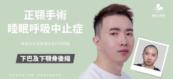重度睡眠呼吸中止症患者正顎手術案例主視覺，標示下巴及下顎骨後縮