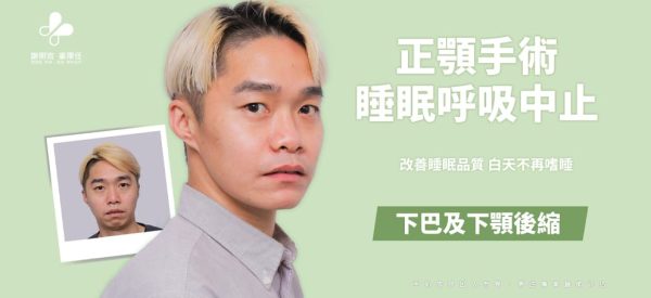 中度睡眠呼吸中止症患者正顎手術案例主視覺，標示下巴及下顎後縮