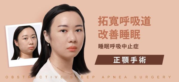 做過拔牙矯正，因為呼吸中止再做正顎手術