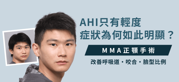 AHI僅7.9的短臉症候群患者接受MMA正顎手術改善呼吸道與咬合