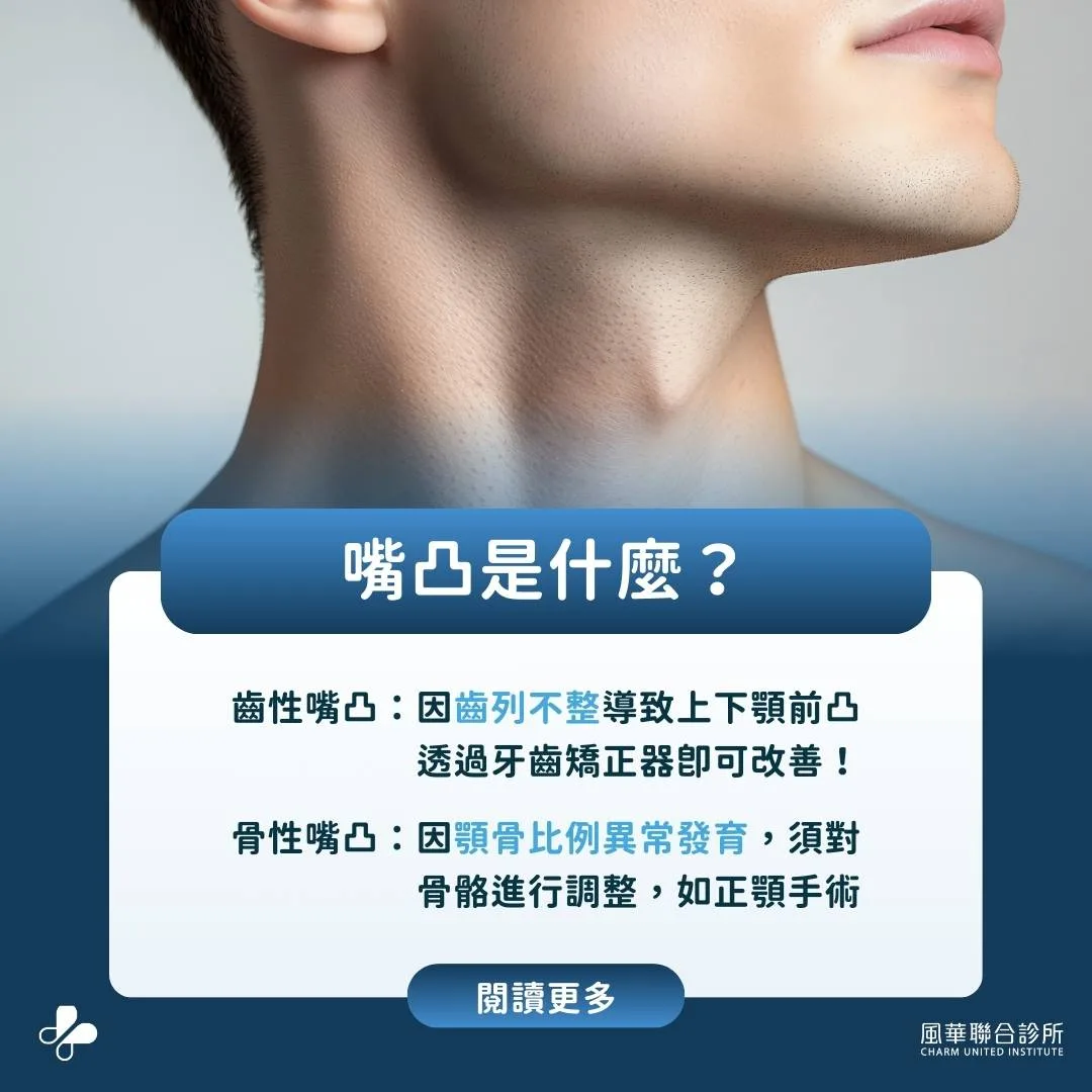 What is a protruding mouth?